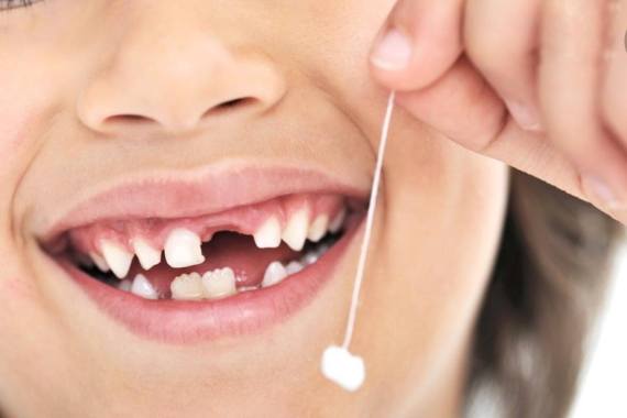 Молочні зуби