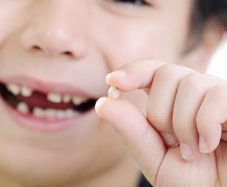 залишився корінь молочного зуба, видалення зуба дитині