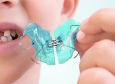 пластини для вирівнювання зубів ціни без брекетів