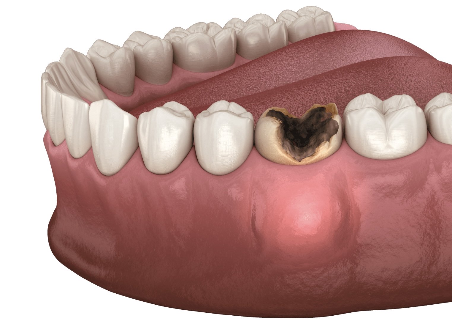 періостит це, лікування у Львові