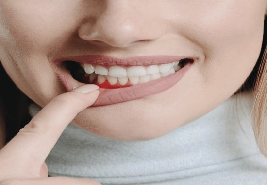 гінгівіт у дітей фото