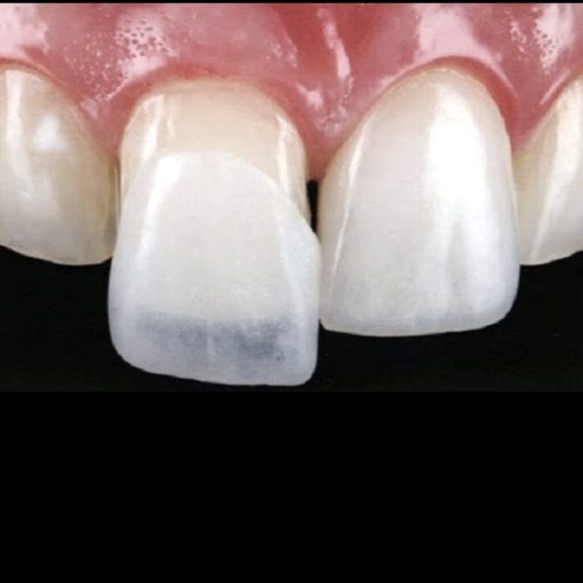 люмініри ціна львів