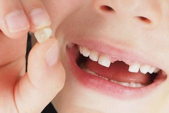 коли випадають молочні зуби