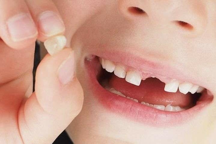 коли випадають молочні зуби