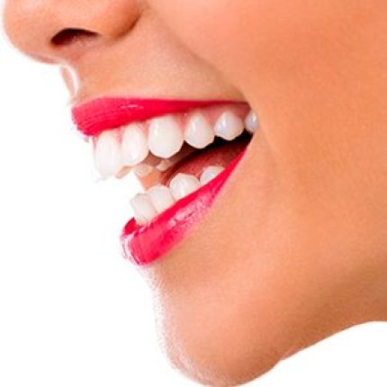 Cariesprevention (fluorideenamel remineralization, fissuresealing)