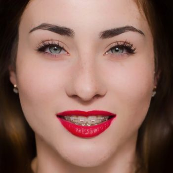 Ortodoncja (nakładki, aparaty ortodontyczne)