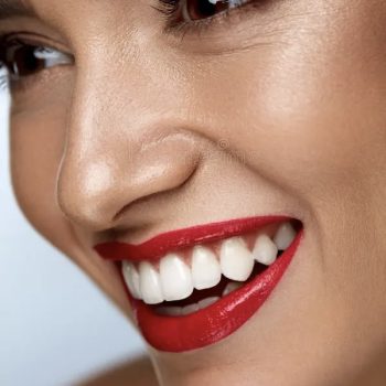 керамічні вініри у Львові, вартість встановлення керамічних внірів