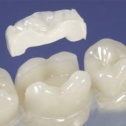 накладка оверлей